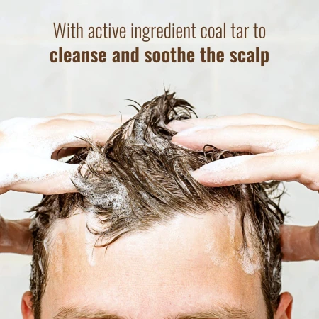 Polytar Scalp Shampoo 150ml, Treats Psoriasis, Seborrhoeic Dermatitis, Eczema, and Dandruff, Soothes Itchy, Scaly Scalps, Contains Coal Tar 4.jpg