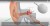 Otovent Adult Autoinflation Device - Treatment for Glue Ear Or Otitis Media with Effusion  5.jpg