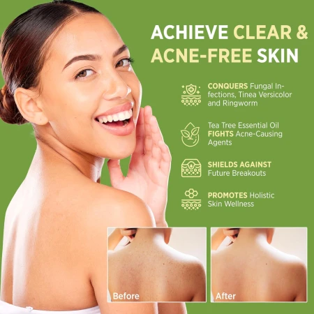 RoyceDerm Antifungal Antibacterial Tea Tree Soap 3.jpg
