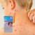 Care ViraSoothe Chickenpox Relief, Cools + Soothes Skin, 6+ Months, Supports Natural Healing, Helps Stop The Itch, Clinically Proven Effective Relief Spray Gel 60g 4.jpg