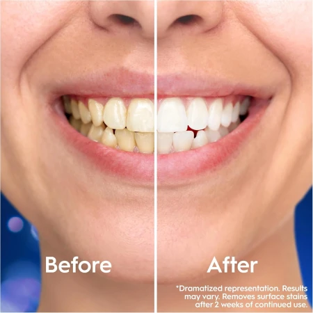 Oral-B Pro 3D White Clinical Intensive Whitening Bright Brilliance Toothpaste 75ml 3.webp