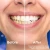 Oral-B Pro 3D White Clinical Intensive Whitening Bright Brilliance Toothpaste 75ml 3.webp